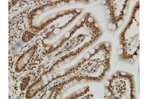 Immunoperoxidase of monoclonal antibody to YY1 on formalin-fixed paraffin-embedded human small Intestine. (YY1 antibody  (AA 221-320))