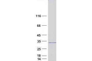 Zinc Finger, CCHC Domain Containing 24 (ZCCHC24) protein (Myc-DYKDDDDK Tag)