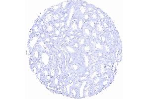 Kidney medulla (Recombinant Prostate Specific Antigen antibody  (AA 150-250))