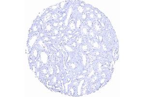 Kidney medulla (Recombinant Prostate Specific Antigen antibody  (AA 150-250))