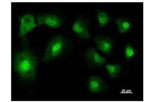Immunostaining analysis in HT1080 cells. (NARS antibody)
