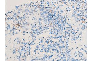 Immunohistochemistry (IHC) image for anti-Checkpoint Kinase 1 (CHEK1) (pSer286) antibody (ABIN6255167)