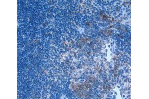 IHC-P analysis of Human Tissue, with DAB staining. (CCL3 antibody  (AA 27-92))