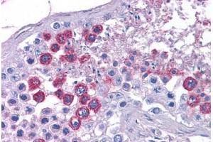 Human Testis: Formalin-Fixed, Paraffin-Embedded (FFPE) (ATP11A antibody  (N-Term))