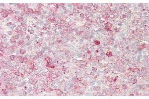 Immunohistochemistry (IHC) image for anti-Protein Kinase N1 (PKN1) (AA 615-874) antibody (ABIN7439912)