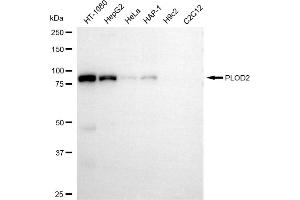 Western blotting analysis using PLOD2 antibody (ABIN7799903).