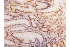 IHC-P analysis of Human Stomach Tissue, with DAB staining. (HNRNPA2B1 antibody  (AA 21-103))