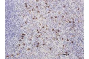 Image no. 3 for anti-Kv Channel Interacting Protein 2 (KCNIP2) (AA 1-100) antibody (ABIN466204) (KCNIP2 antibody  (AA 1-100))