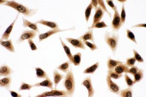Immunohistochemistry (IHC) image for anti-Budding Uninhibited By Benzimidazoles 3 Homolog (Yeast) (BUB3) (AA 76-90), (Middle Region) antibody (ABIN3044239)