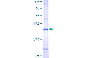 SLC3A1 Protein (AA 211-320) (GST tag)