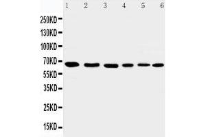 Anti-AIF antibody, Western blotting Lane 1: Rat Heart Tissue Lysate Lane 2: Rat Brain Tissue Lysate Lane 3: K562 Cell Lysate Lane 4: HEPG2 Cell Lysate Lane 5: A431 Cell Lysate Lane 6: NIH3T3 Cell Lysate (AIF antibody  (C-Term))