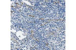 IHC analysis of CD31/PECAM1 using anti-CD31/PECAM1 antibody (ABIN7601076).