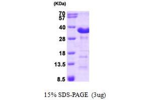 SDS-PAGE (SDS) image for Aspartate beta-Hydroxylase (ASPH) (AA 75-270) protein (His tag) (ABIN667766) (Aspartate beta Hydroxylase Protein (AA 75-270) (His tag))