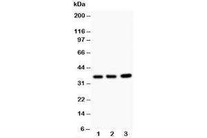 Western blot testing of TNFAIP1 antibody and Lane 1:  rat thymus;  2: HeLa;  3: COLO320;  Predicted size: 36KD;  Observed size: 36KD (TNFAIP1 antibody  (N-Term))