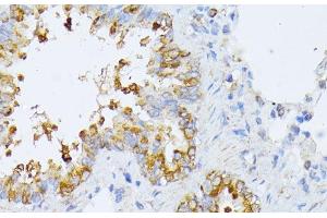 Immunohistochemistry of paraffin-embedded Rat lung using EIF2B2 Polyclonal Antibody at dilution of 1:100 (40x lens).