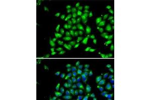 Immunofluorescence analysis of MCF7 cells using ARFGAP1 Polyclonal Antibody (ARFGAP1 antibody)