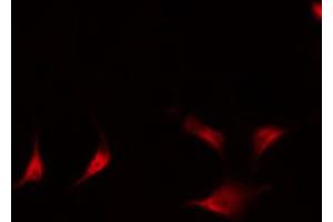 Immunofluorescence (fixed cells) (IF/ICC) image for anti-Nuclear Factor of kappa Light Polypeptide Gene Enhancer in B-Cells 2 (NFKB2) (pSer870) antibody (ABIN6255542)