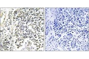 Immunohistochemistry (IHC) image for anti-Nuclear Factor of kappa Light Polypeptide Gene Enhancer in B-Cells Inhibitor, alpha (NFKBIA) (AA 268-317), (pTyr305) antibody (ABIN1531661)