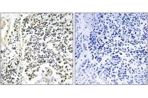 Immunohistochemistry analysis of paraffin-embedded human lymph node, using IkappaB-alpha (Phospho-Tyr305) Antibody. (NFKBIA antibody  (pTyr305))