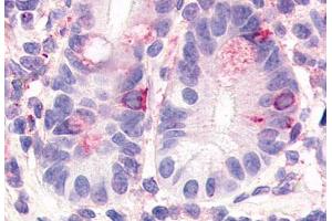 Anti-HNF4G antibody  ABIN1048955 IHC staining of human small intestine. (HNF4 gamma antibody  (Internal Region))