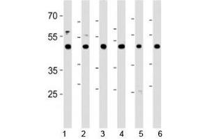 CTBP1 antibody western blot analysis in 1) HeLa, 2) HL-60, 3) Jurkat, 4) Raji cell lines, 5) mouse brain and 6) rat brain tissue lysate. (CTBP1 antibody  (AA 413-440))