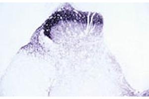 Immunohistochemical staining of Trpv2 in rat dorsal horn using Trpv2 polyclonal antibody . (TRPV2 antibody  (AA 744-761))
