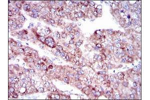 Immunohistochemistry (IHC) image for anti-Solute Carrier Family 27 (Fatty Acid Transporter), Member 5 (SLC27A5) (AA 508-570) antibody (ABIN1845743) (SLC27A5 antibody  (AA 508-570))