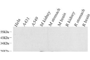 Western Blot analysis of various samples using NTS Polyclonal Antibody at dilution of 1:1000. (Neurotensin antibody)