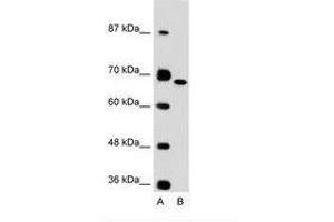 Image no. 1 for anti-Fibronectin 1 (FN1) (C-Term) antibody (ABIN6736615)