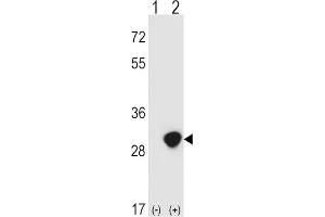 Western Blotting (WB) image for anti-Triosephosphate Isomerase 1 (TPI1) antibody (ABIN3001712) (TPI1 antibody)
