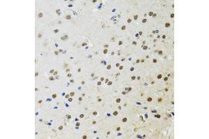 Immunohistochemistry of paraffin-embedded mouse brain using BTK antibody (ABIN3022170, ABIN3022171, ABIN3022172 and ABIN6218643) at dilution of 1:100 (40x lens). (BTK antibody  (AA 30-240))