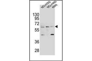 Western blot analysis of CD85h / LILRA2 Antibody (Center) in NCI-H292,NCI-H460 and A549 cell line lysates (35ug/lane). (LILRA2 antibody  (Middle Region))