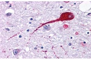 Image no. 1 for anti-Neuromedin U Receptor 2 (NMUR2) (Cytoplasmic Domain) antibody (ABIN1049107) (NMUR2 antibody  (Cytoplasmic Domain))