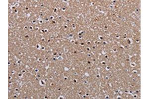 The image on the left is immunohistochemistry of paraffin-embedded Human brain tissue using ABIN7130211(MECP2 Antibody) at dilution 1/60, on the right is treated with fusion protein.