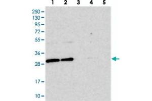 Western blot analysis of Lane 1: RT-4, Lane 2: U-251 MG, Lane 3: Human Plasma, Lane 4: Liver, Lane 5: Tonsil with BCDIN3D polyclonal antibody  at 1:250-1:500 dilution. (BCDIN3D antibody)