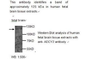 Image no. 1 for anti-Adenylate Cyclase 2 (Brain) (ADCY2) antibody (ABIN790777) (ADCY2 antibody)