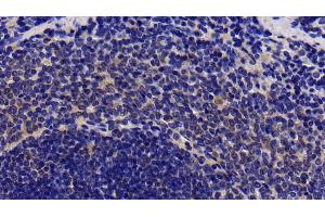 Detection of IL1R1 in Rat Spleen Tissue using Polyclonal Antibody to Interleukin 1 Receptor Type I (IL1R1) (IL1R1 antibody  (AA 226-352))