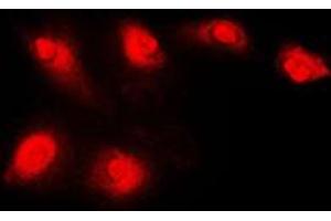 Immunofluorescent analysis of Histone Deacetylase 5 staining in Jurkat cells.