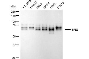 Western blotting analysis using TFE3 antibody (ABIN7800594).