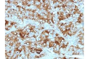 Formalin-fixed, paraffin-embedded adrenal gland stained with Chromogranin A antibody cocktail (Chromogranin A antibody)