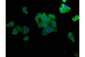 Immunofluorescence staining of HepG2 cells with ABIN7160070 at 1:50, counter-stained with DAPI. (MAP4K4 antibody  (AA 866-1104))