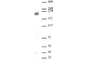 DOT1L antibody (pAb) tested by Western blot. (DOT1L antibody  (C-Term))