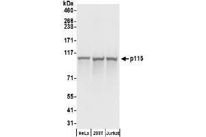 Western Blotting (WB) image for anti-rho GTPase Activating Protein 4 (ARHGAP4) (AA 912-962) antibody (ABIN7455040) (ARHGAP4 antibody  (AA 912-962))