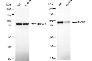anti-Procollagen-Lysine 2-Oxoglutarate 5-Dioxygenase 2 (PLOD2) antibody
