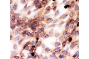 ICC testing of Gelsolin antibody and NIH3T3 cells