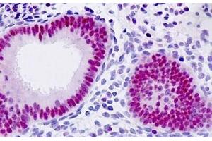 Human Uterus, Endometrium: Formalin-Fixed, Paraffin-Embedded (FFPE) (p21 antibody  (AA 111-160))