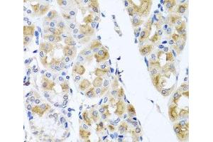 Immunohistochemistry of paraffin-embedded Human stomach using TMEM43 Polyclonal Antibody at dilution of 1:100 (40x lens).