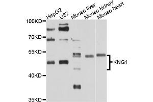Western blot analysis of extracts of various cell lines, using KNG1 antibody (ABIN5970830) at 1/1000 dilution. (KNG1 antibody)