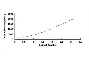 Typical standard curve (SERPINA1 ELISA Kit)