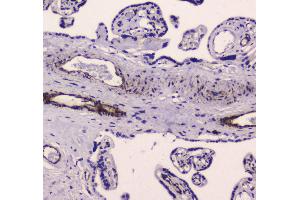 IHC analysis of MYLK using anti-MYLK antibody . (MYLK antibody  (AA 1441-1709))